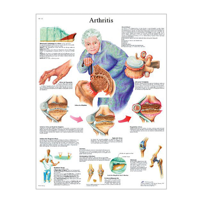 English Anatomical chart