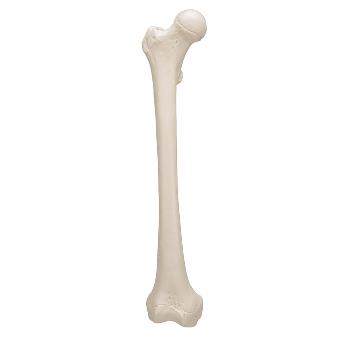 Model femur