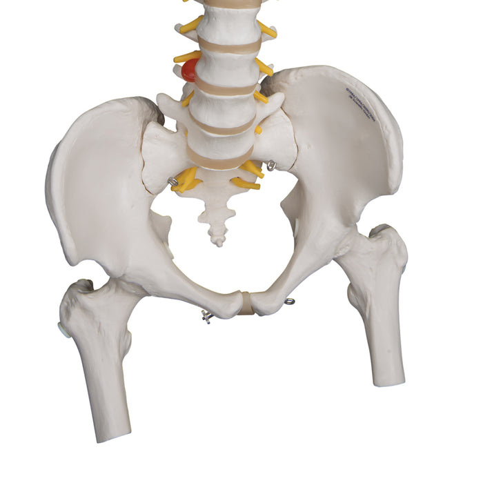 Model: flexible spine with femur heads