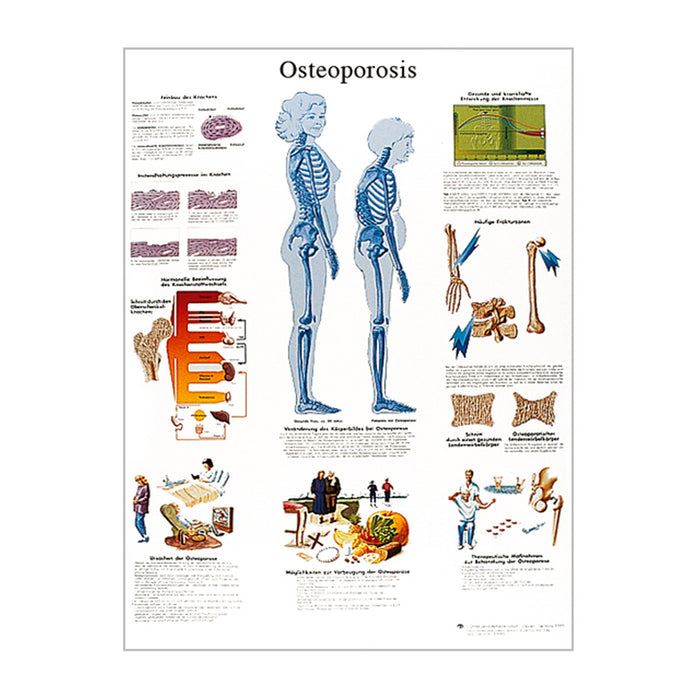 English Anatomical chart