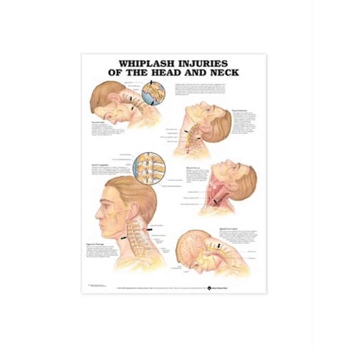 English Anatomical chart