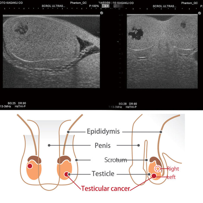 Scrotal ultrasound Phantom