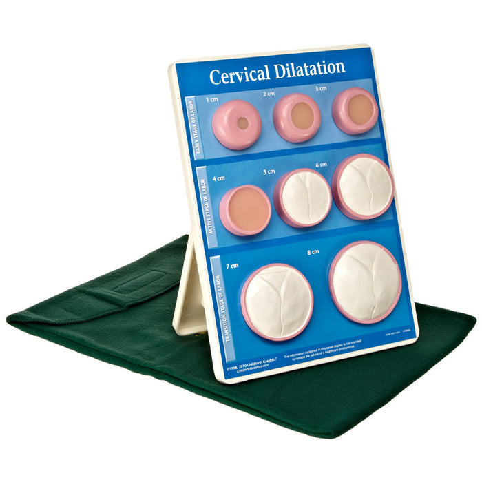 Model: Cervical dilation easel display