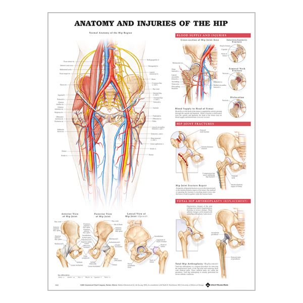 Chart "Anatomy & injuries of the hip"