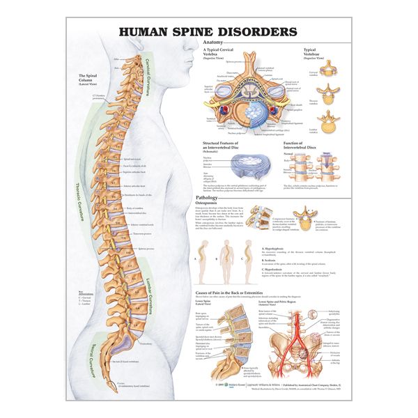 Chart "Human spine disorders"